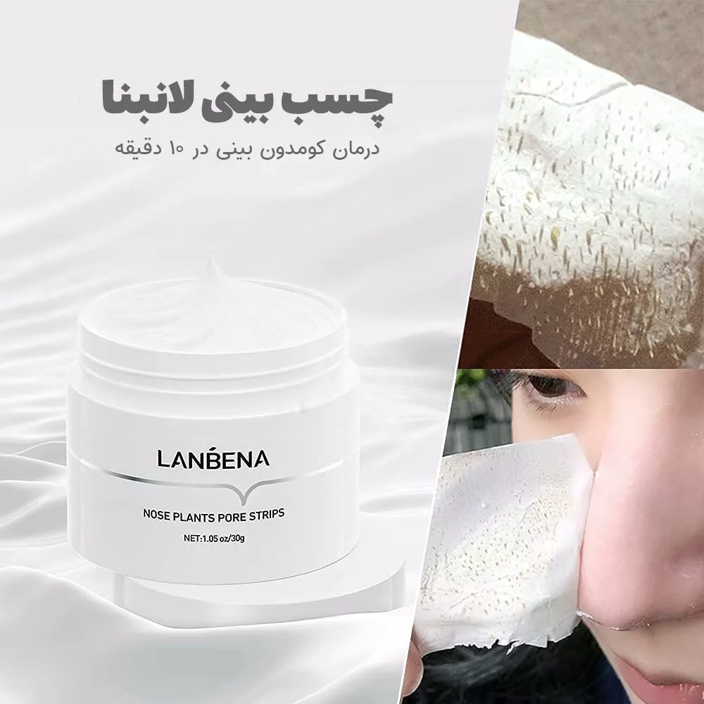 چسب جوش سرسیاه