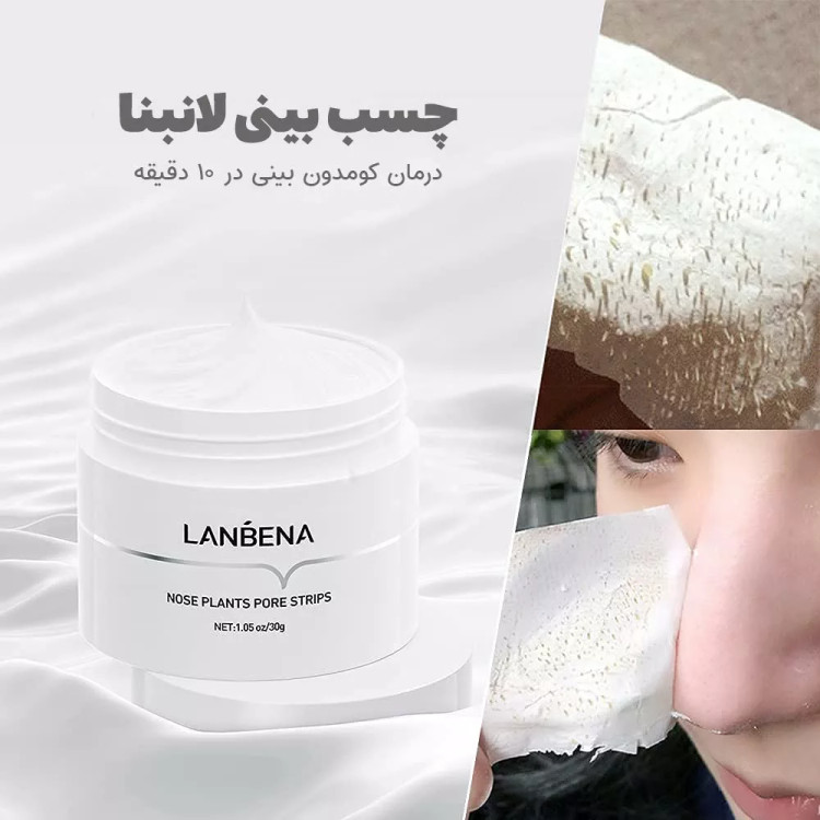 چسب جوش سرسیاه