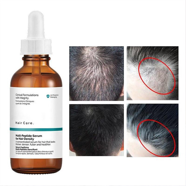 سرم پرپشت کننده مو